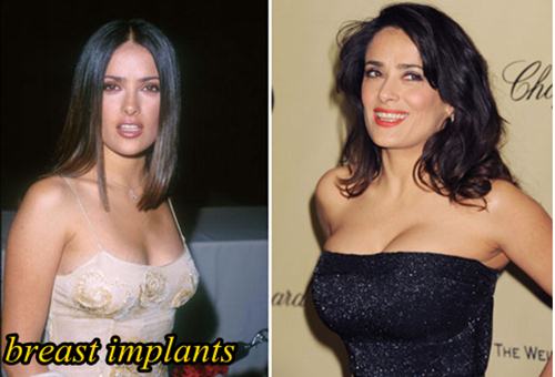 Salma-Hayek-Plastic-Surgery-Breast-Implants.jpg