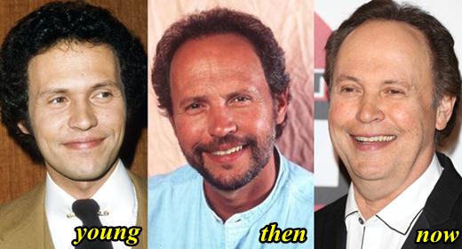 Billy Crystal Plastic Surgery before after