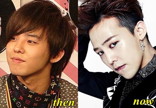 Plastic Surgery On Idols You Stare At Page 7 Allkpop Forums