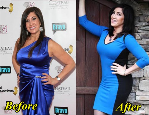  Jacqueline Laurita Plastic Surgery Before and After Tummy Tuck, Boob Job