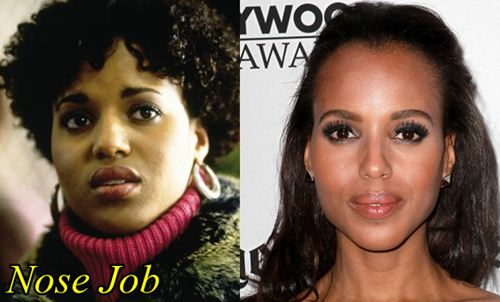 Kerry Washington Plastic Surgery Before and After Nose Job.