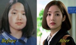 Park Min Young Plastic Surgery Before After
