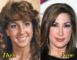 Jacqueline Laurita Plastic Surgery Before and After Tummy Tuck, Boob Job