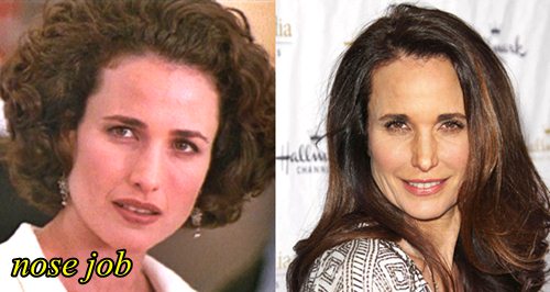 Andie Macdowell Plastic Surgery Before and After