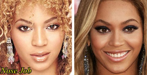 Beyonce Plastic Surgery Before After Nose Job