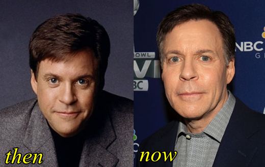 Bob Costas Plastic Surgery Before and After. 