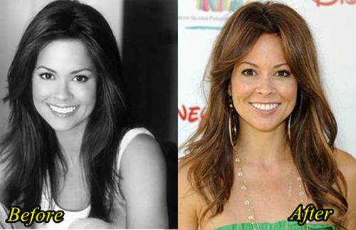 Brooke Burke Plastic Surgery Before and After