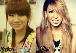CL 2NE1 Plastic Surgery Before and After Pictures