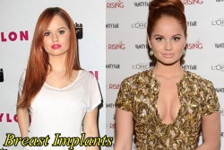Debby Ryan Plastic Surgery Before and After Breast Implants