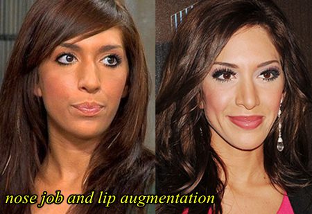 Farrah Abraham Plastic Surgery Nose Job an Lip Augmentation