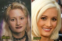 Holly Madison Plastic surgery Before and After