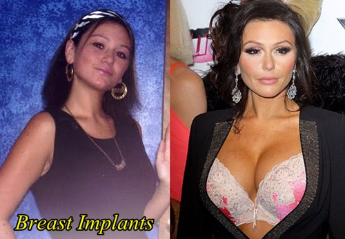 Jwoww Plastic Surgery Before and After Breast implants