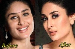 Kareena Kapoor Plastic surgery Before and After