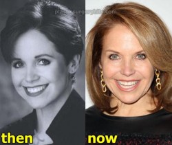 Katie Couric Plastic Surgery Before and After