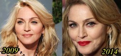 Madonna Plastic Surgery Before After