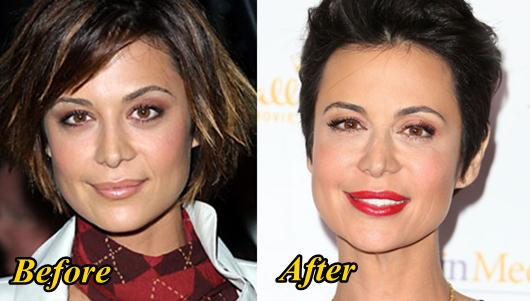 Catherine Bell Plastic Surgery Before and After.