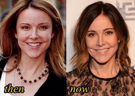 Christa Miller Plastic Surgery Before and After
