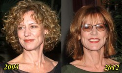 Christine Lahti Plastic Surgery Before and After