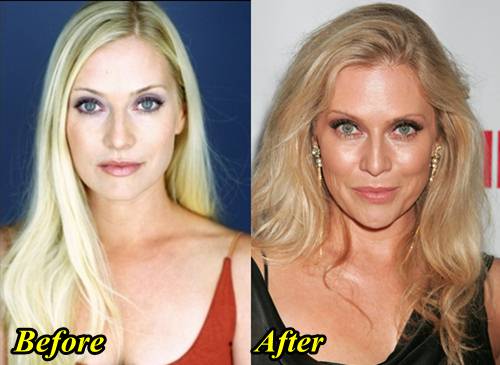 Emily Procter Plastic Surgery Before and After. 