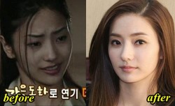 Han Chae Young Plastic Surgery Before and After