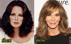 Jaclyn Smith Plastic Surgery Before and After