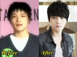 Jaejoong Plastic Surgery Before and After