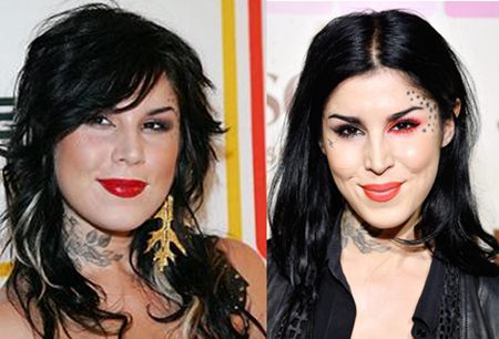 Kat Von D Plastic Surgery Before and After