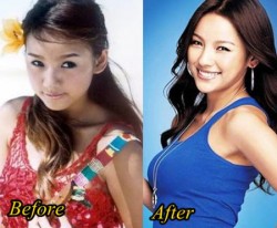 Lee Hyori Plastic Surgery Before and After