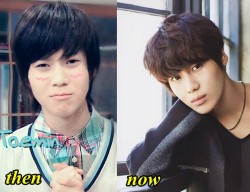 Lee Taemin Shinee Plastic Surgery Before and After