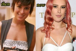 Rumer Willis Plastic Surgery Before and After Picture