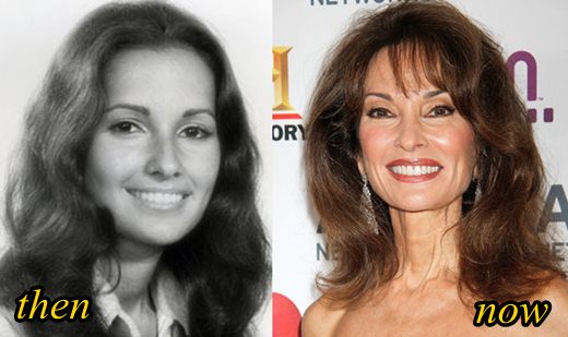 Susan Lucci Plastic Surgery Before and After Picture