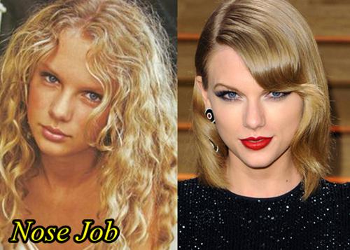 Taylor Swift Plastic Surgery Before and After Nose Job