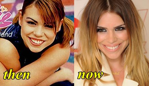 Billie Piper Plastic surgery Before and After