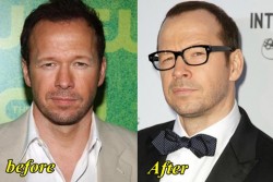 Donnie Wahlberg Plastic Surgery Before and After