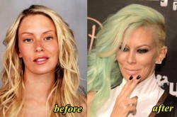 Jenna Jameson Plastic Surgery Before and After