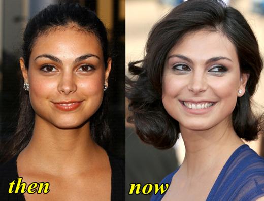 Morena Baccarin Plastic Surgery Before and After.