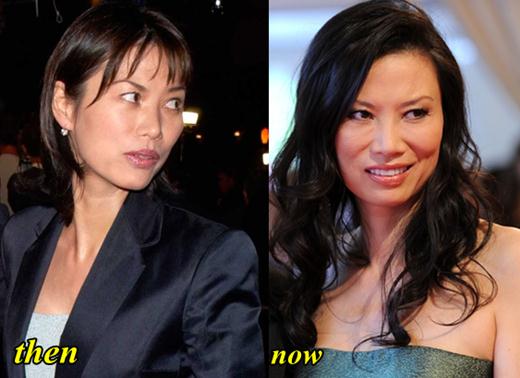 Wendi Deng Plastic Surgery Before and After