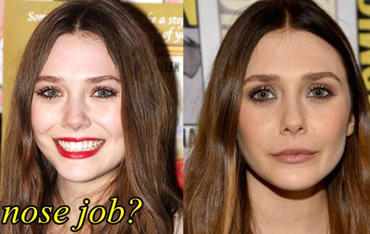 Elizabeth Olsen Nose Job Before and After, Plastic Surgery Fact or Rumor? 