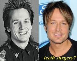 Keith Urban Plastic Surgery Before and After