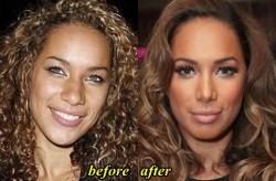 Leona Lewis Nose Job Before and After