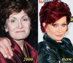 Sharon Osbourne Plastic Surgery