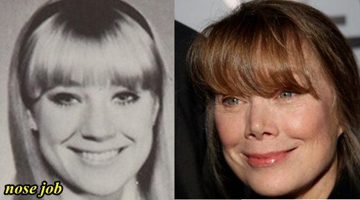 Sissy Spacek Nose Job Before and After. 