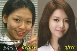 Sooyoung Plastic Surgery