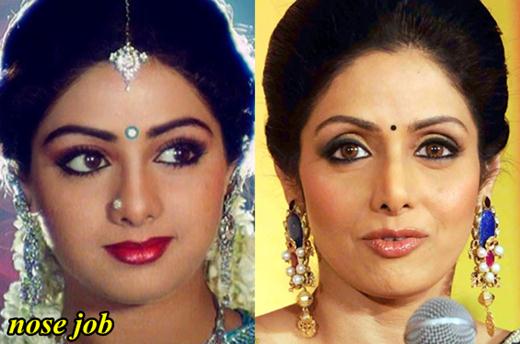 Sridevi Plastic Surgery Before and After