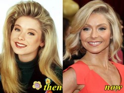 Kelly Ripa Plastic Surgery Before and After