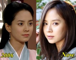 Song Ji Hyo Plastic Surgery