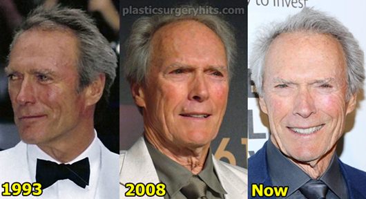 Clint Eastwood Plastic Surgery Before and After
