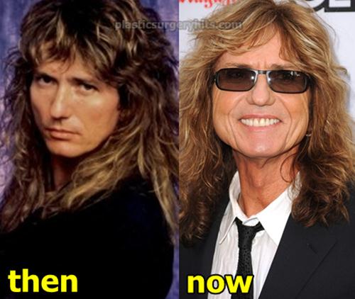 David Coverdale Plastic Surgery Before and After