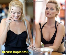 Margot Robbie Breast Implants