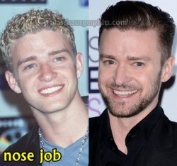 Justin Timberlake Nose Job